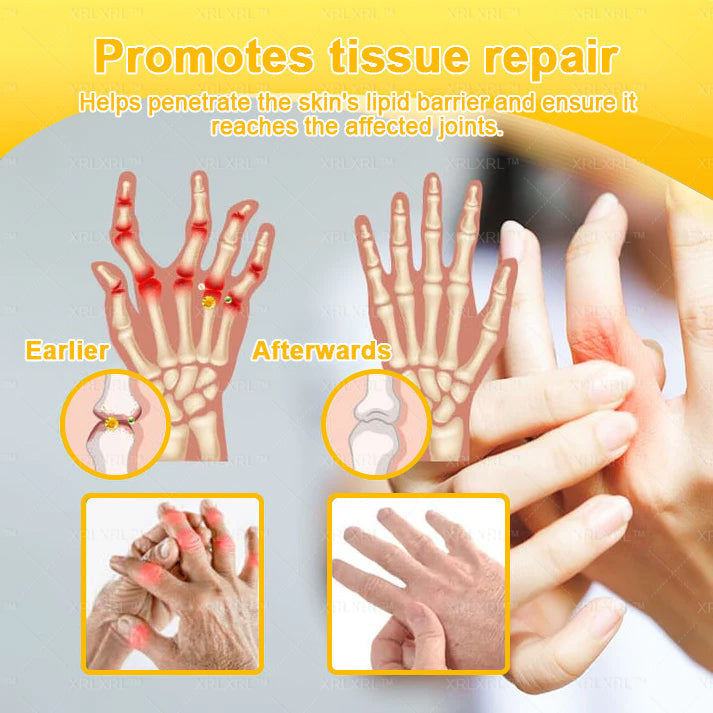 XRLXRL® Bee Venom Pain-Relief Bone Healing Cream🏃‍♀️🏃‍♀️(Specially for older adults)