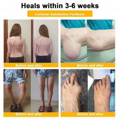 XRLXRL® Bee Venom Pain-Relief Bone Healing Cream🏃‍♀️🏃‍♀️(Specially for older adults)