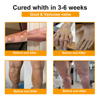 XRLXRL® Bee Venom Pain-Relief Bone Healing Cream🏃‍♀️🏃‍♀️(Specially for older adults)