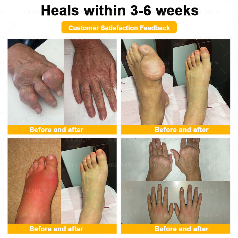 XRLXRL® Bee Venom Pain-Relief Bone Healing Cream🏃‍♀️🏃‍♀️(Specially for older adults)