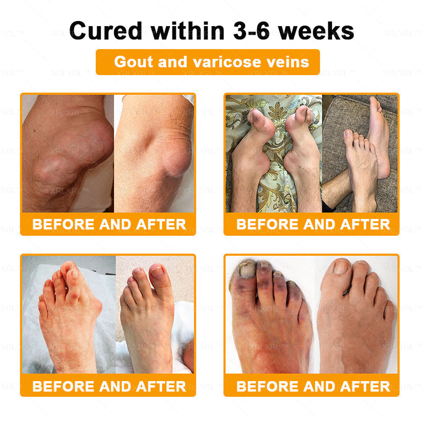 XRLXRL® Bee Venom Pain-Relief Bone Healing Cream🏃‍♀️🏃‍♀️(Specially for older adults)