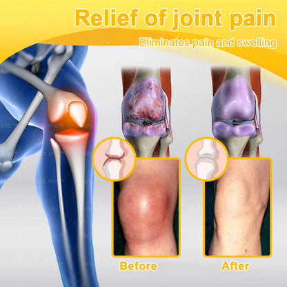 XRLXRL® Bee Venom Pain-Relief Bone Healing Cream🏃‍♀️🏃‍♀️(Specially for older adults)